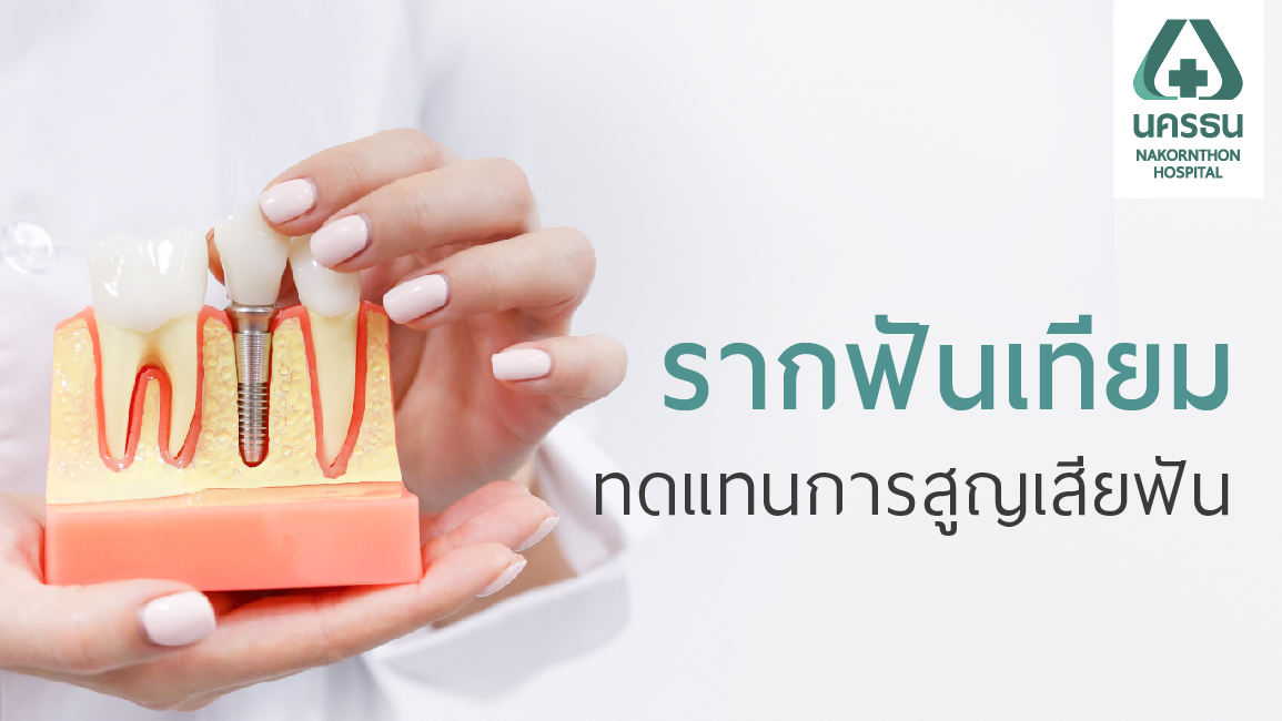 คลายข้อสงสัย ทำรากฟันเทียมแล้วดีอย่างไร?